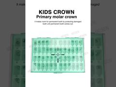 نگاهی دقیق تر: تاج مولر اولیه KIDS CROWN